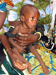 nigeria_dziecko_afp_180